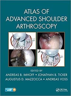 دانلود کتاب Atlas of Advanced Shoulder Arthroscopy