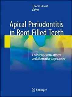 دانلود کتاب Apical Periodontitis in Root-Filled Teeth