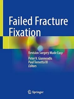 دانلود کتاب Failed Fracture Fixation: Revision Surgery Made Easy