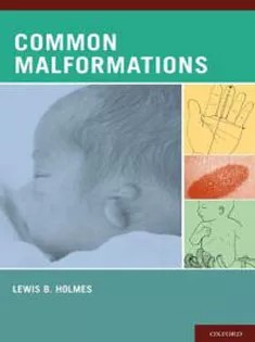 دانلود کتاب Common Malformations