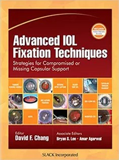 دانلود کتاب Advanced IOL Fixation Techniques