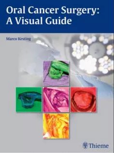 دانلود کتاب Oral Cancer Surgery: A Visual Guide