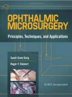 دانلود کتاب Ophthalmic Microsurgery: Principles, Techniques, and Applications