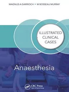 دانلود کتاب Self Assessment Colour Review of Anaesthesia