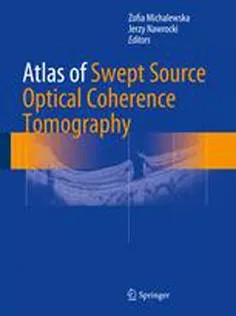 دانلود کتاب Atlas of Swept Source Optical Coherence Tomography