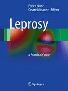 دانلود کتاب Leprosy: A Practical Guide