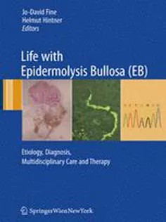 دانلود کتاب Life with Epidermolysis Bullosa(EB