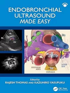 دانلود کتاب Endobronchial Ultrasound Made Easy: Made Easy