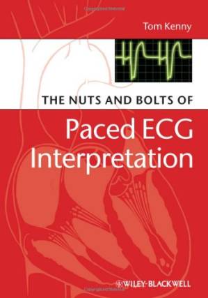 دانلود کتاب The Nuts and bolts of Paced ECG Interpretation (Nuts and Bolts Series)