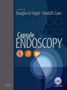 دانلود کتاب Capsule Endoscopy