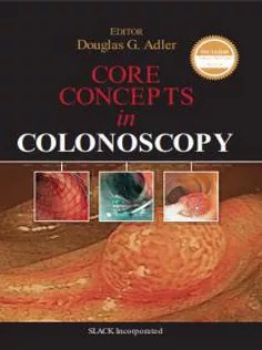دانلود کتاب Core Concepts in Colonoscopy
