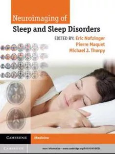 دانلود کتاب Neuroimaging of Sleep and Sleep Disorders