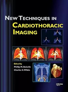 دانلود کتاب New Techniques in Cardiothoracic Imaging