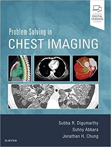 دانلود كتاب Problem Solving in Chest Imaging 1st Edition