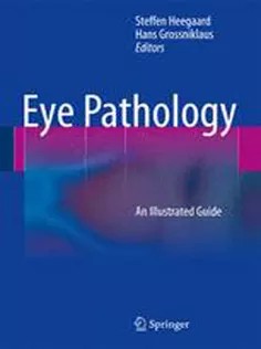 دانلود کتاب Eye Pathology: An Illustrated Guide