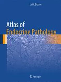 دانلود کتاب Atlas of Endocrine Pathology