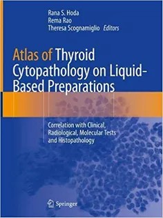 دانلود کتاب Atlas of Thyroid Cytopathology on Liquid-Based Preparations