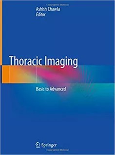 دانلود کتاب Thoracic Imaging: Basic to Advanced