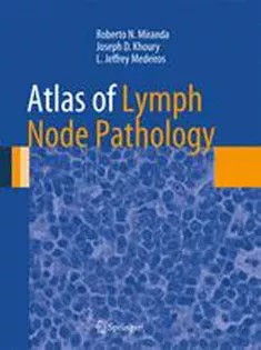 دانلود کتاب Atlas of Lymph Node Pathology