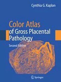 دانلود کتاب Color Atlas Of Gross Placental Pathology