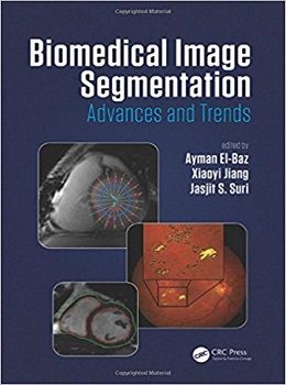 دانلود کتاب تقسیم بندی تصویر بیومدیکال: پیشرفت و روند Biomedical Image Segmentation: Advances and Trends, 1ed