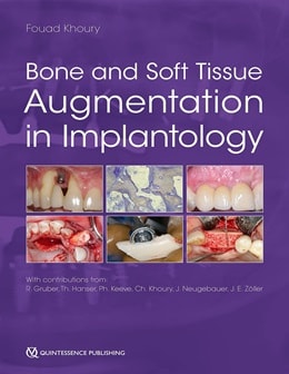 دانلود کتاب تقویت استخوان و بافت نرم در ایمپلنتولوژی\nBone and Soft Tissue Augmentation in Implantology 1st Edition