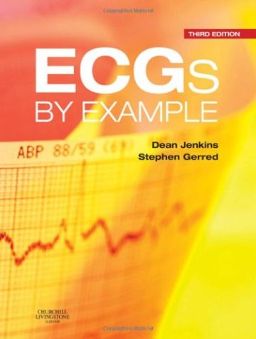 دانلود کتاب الکتروکاردیوگرام ها با مثال، ۲۰۱۱ ECGs by Example 2011