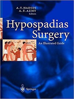 دانلود کتاب جراحی هیپوسپادیاس: راهنمای تصویری Hypospadias Surgery: An Illustrated Guide, 1ed
