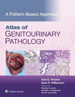دانلود کتاب پاتولوژی دستگاه ادراری تناسلی: رویکردی مبتنی بر الگو Atlas of Genitourinary Pathology: A Pattern Based Approach 1st Edition