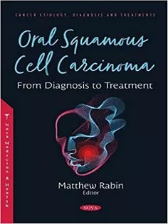 دانلود کتاب Oral Squamous Cell Carcinoma: From Diagnosis to Treatment