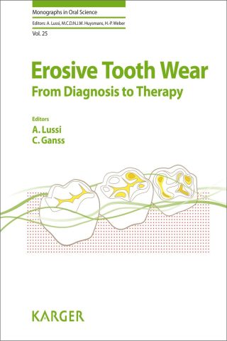 دانلود کتاب سایش فرسایشی دندان ۲۰۱۴ Erosive Tooth Wear 2014