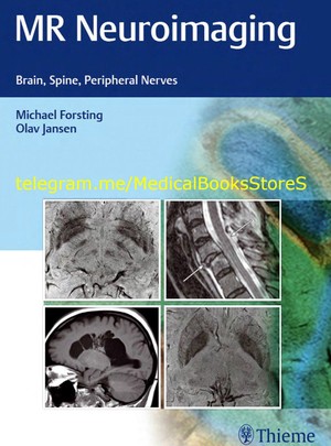 دانلود کتاب MR Neuroimaging