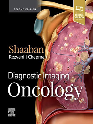 دانلود کتاب Diagnostic Imaging: Oncology