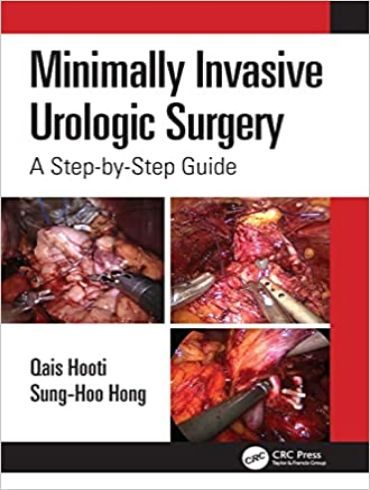 دانلود کتاب Minimally Invasive Urologic Surgery: A Step-by-Step Guide 1st Edition