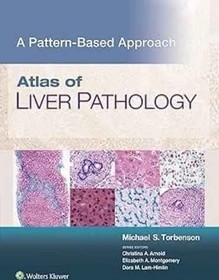 دانلود کتاب Atlas of Liver Pathology: A Pattern-Based Approach 1st Edition