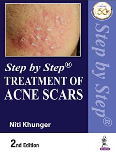 دانلود کتاب Step by Step Treatment of Acne Scars 2nd Edition