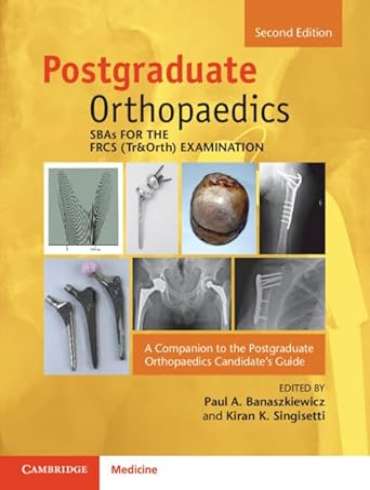 دانلود کتاب Postgraduate Orthopaedics Candidate’s Guide 2nd Edition