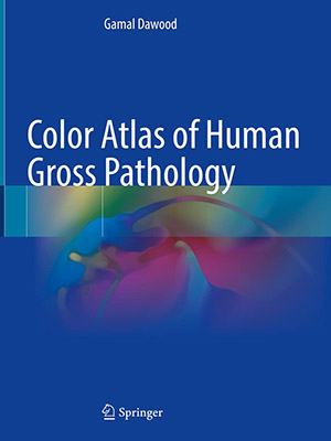 دانلود کتاب Color Atlas of Human Gross Pathology