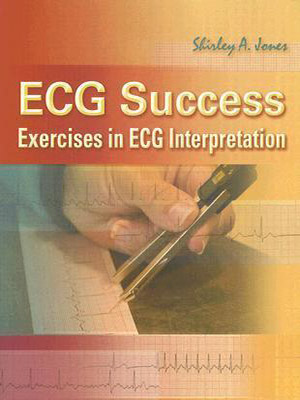 دانلود کتاب ECG Success: Exercises in ECG Interpretation