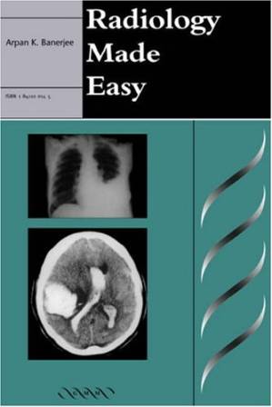 دانلود کتاب Radiology Made Easy
