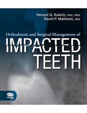 دانلود کتاب Orthodontic And Surgical Management Of Impacted Teeth, 2014