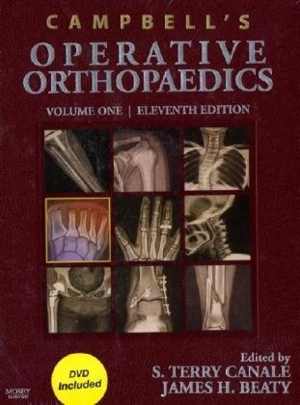 دانلود کتاب Campbell’s Operative Orthopaedics – 4-Volume Set, 11th ed, 2007