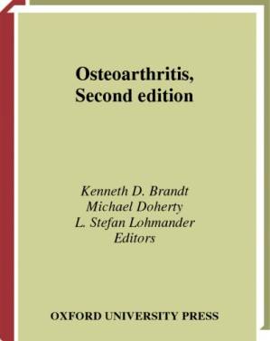 دانلود کتاب Osteoarthritis 2nd edition