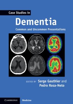 دانلود کتاب Case Studies in Dementia: Common and Uncommon Presentations (Case Studies in Neurology)