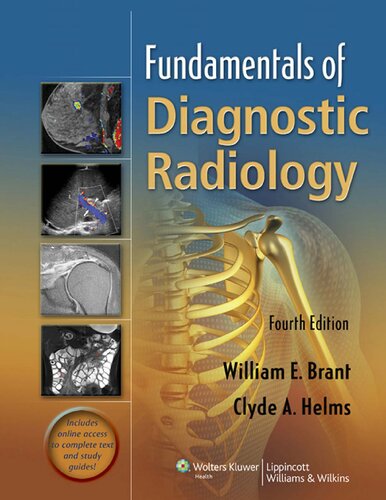دانلود کتاب Fundamentals of Diagnostic Radiology (4th Edition