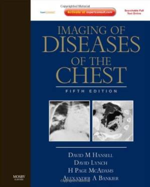دانلود کتاب Imaging of Diseases of the Chest, 5Th Edition