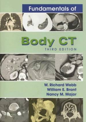 دانلود کتاب Fundamentals of Body CT (3rd Edition)