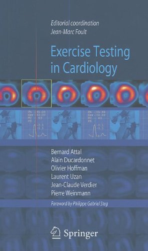 دانلود کتاب Exercise testing in cardiology