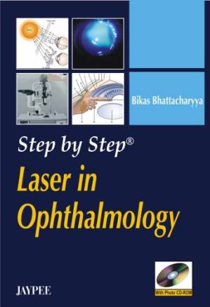 دانلود کتاب Step by Step Laser in Ophthalmology