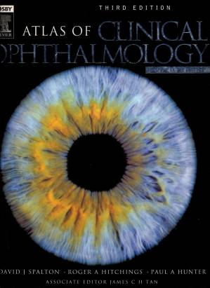 دانلود کتاب Atlas of Clinical Ophthalmology, Third Edition